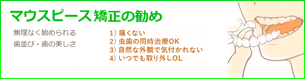 マウスピース矯正の勧め