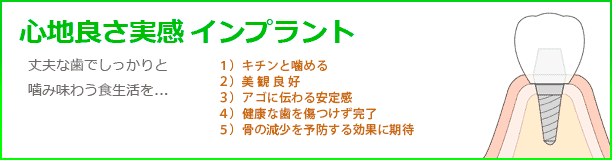 心地良さ実感インプラント